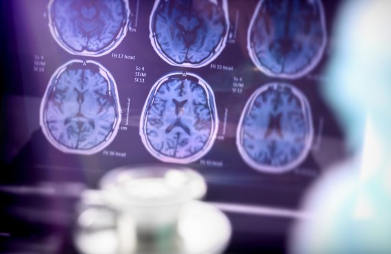 Wissenschaftliche Analyse des Gehirns im Krankenhaus, konzeptionelles Bild